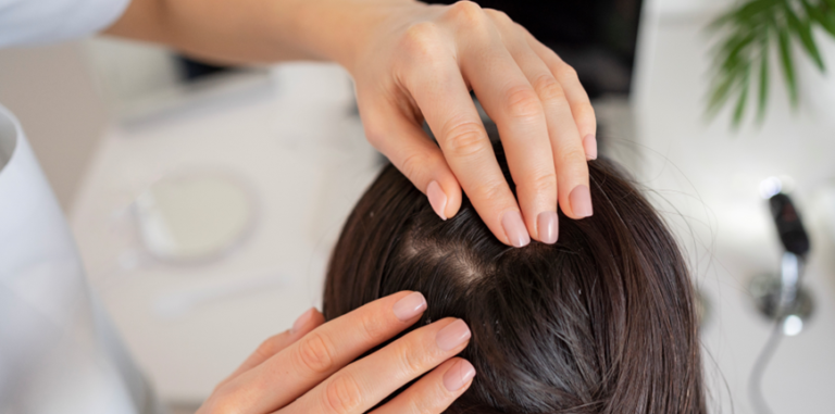 Tratamentos para queda de cabelo: quais realmente funcionam e são comprovados?