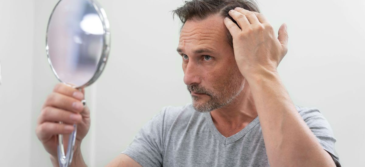 Diferença entre queda de cabelo e calvície